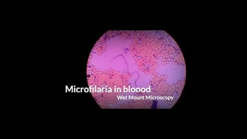 Live Blood Parasite/Microfilaria in Wet Mount Microscopy