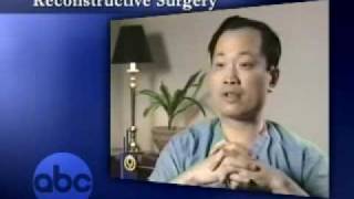 Celebrity Mathew's eye reconstruction by Dr. Ming Wang Net Worth