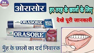orasore mouth ulcer gel how to use | मुँह के छालो के लिए  orasore gel by Prince Azeemuddin