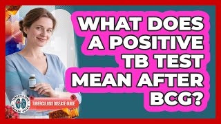 What Does a Positive TB Test Mean After BCG?