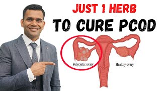 Just 1 Teaspoon Per Day To Cure PCOD\/PCOS \& Irregular Periods Permanently