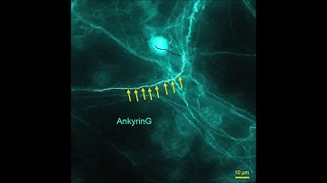 An axon initial segment is required for temporal precision in action potential encoding by neuronal