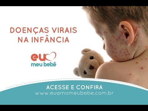 Vídeo: Sarampo, Catapora, Rubéola E Outras Doenças Infecciosas Em Uma Criança