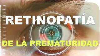 Cómo se clasifica la retinopatía del prematuro