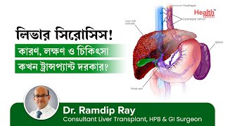 লিভার সিরোসিসের কারণ, লক্ষণ ও চিকিৎসা | Liver Cirrhosis: Causes, Symptoms & Treatment