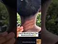 Rid Of Dark Neck | Remove Neck Darkness &amp; Tanning Easily #darkneck #ytshorts