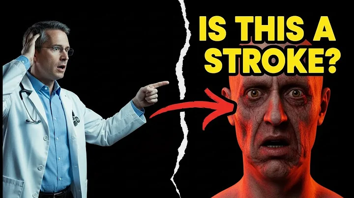 How to Spot a Stroke in Minutes & Save a Life (BE FAST)