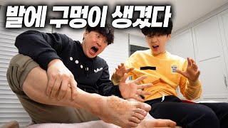 발에 이상한 구멍이 생겼어요... 피부병인가 ㅠㅠ 전염병은 아니겠죠? screenshot 5