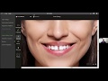 Digital Simulations & Planning Tools in Orthodontics - Dr. Neeraj Rohida