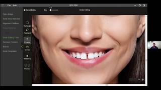 Digital Simulations & Planning Tools in Orthodontics - Dr. Neeraj Rohida