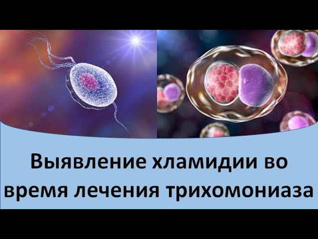 Выявление хламидии во время лечения трихомониаза