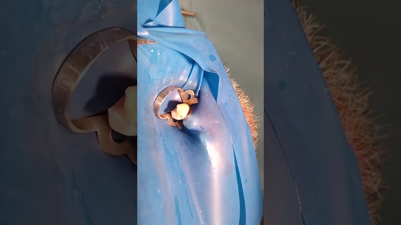 Single isolation 35 tooth.