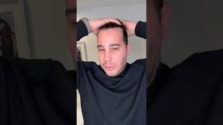 How to use Batana Hair Oil for Thicker, fuller hair How to use Batana Hair Oil for Thicker, fuller hair