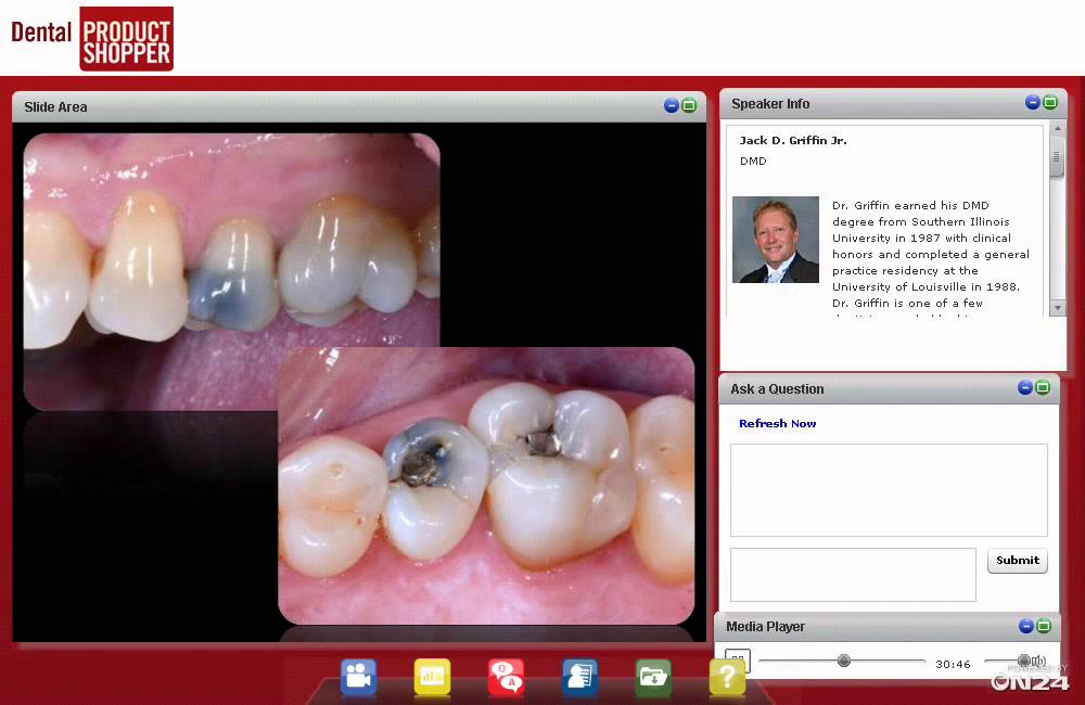 Webinar  3M ESPE  Universally Excellent  Scotchbon