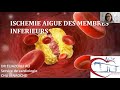 Ischmie aigu des membres inferieurs  service de cardiologie chu ibn rocacir