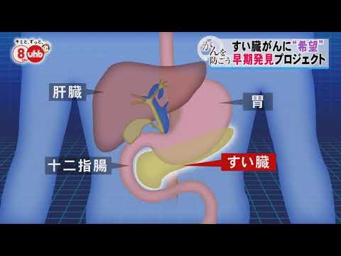 がんを防ごうー2018年5月31日放送 生存率80％へ！すい臓がんを「ステージ0」で発見～早期診断プロジェクトとは？