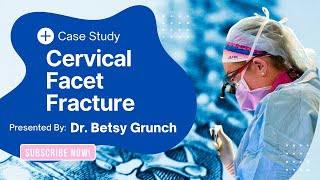 Case Study 161 | Cervical facet fracture | explained by neurosurgeon Dr. Betsy Grunch