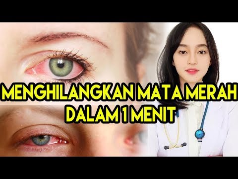 Video: Cara Mudah Menghilangkan Mata Merah Dengan Cepat