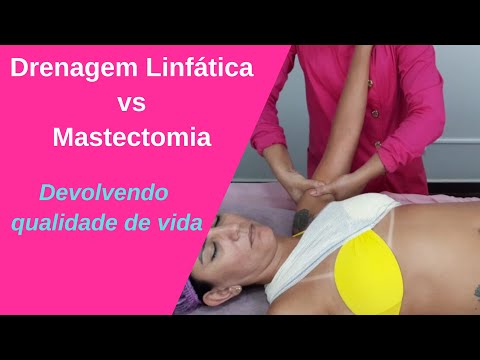 Vídeo: Como reduzir a drenagem após uma mastectomia: 13 etapas