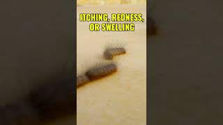 Keep away from hairy caterpillars #firstaid #danger