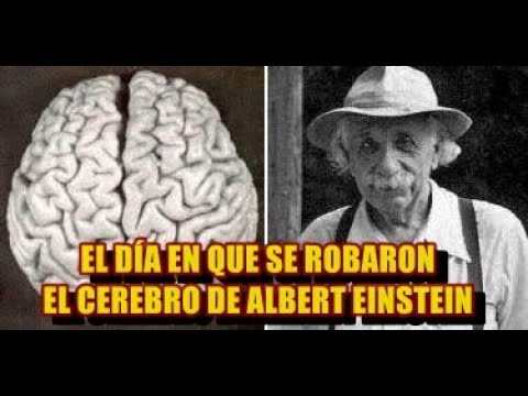 Vídeo: Por Qué El Cerebro De Wolf Messing Fue Valorado En Un Millón De Dólares - Vista Alternativa