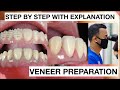 Step by step minimally invasive veneers preparation  general dentist griya rr