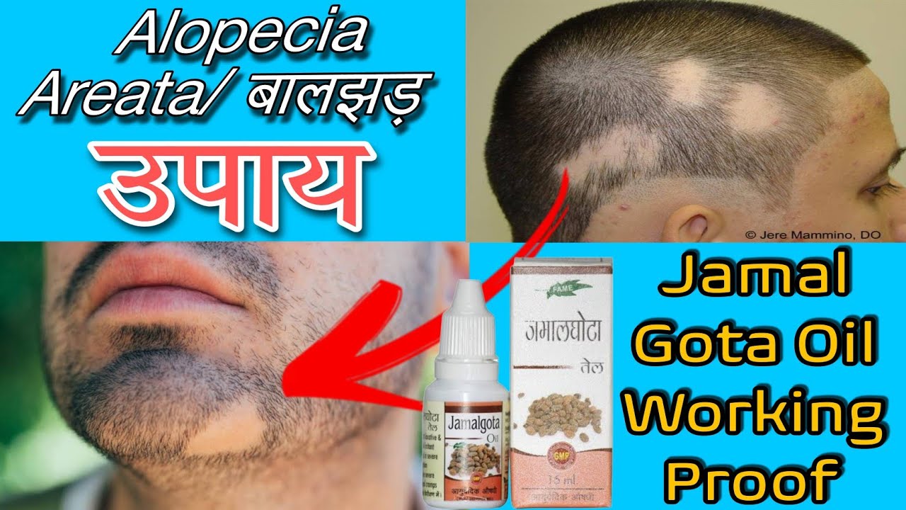 परन स परन गज क सर पर बल उग द यह दव Jamalgota Ke Fayde in  Hindi  YouTube