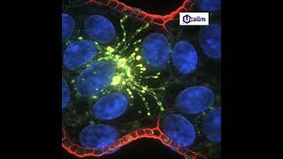 Immunofluorescence with Transwell Inserts: A Strategic Guide
