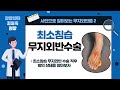 사진으로 보는 무지외반증2 : 최소침습 무지외반수술