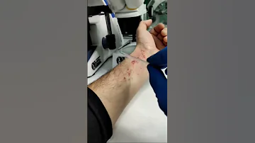 ЧЕСОТОЧНЫЙ КЛЕЩ ИЛИ ЧЕСОТКА ПОД МИКРОСКОПОМ