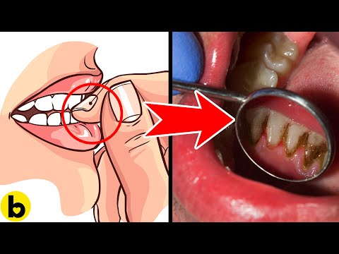 16 Sneaky Reasons Why You Get Cavities