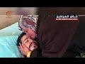أحمد أبو فارة وأنس شديد يصارعان الموت 