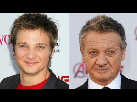 Jeremy Renner's dramatic transformation after an accident