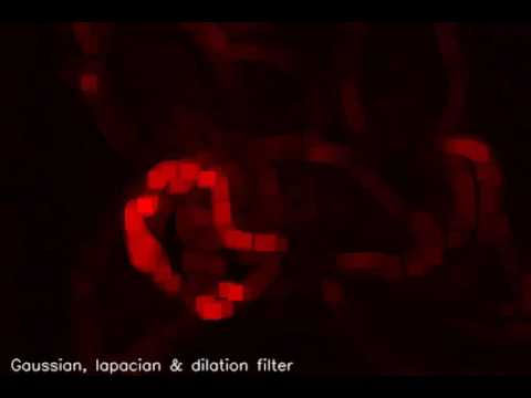 Focus stacking with python 1