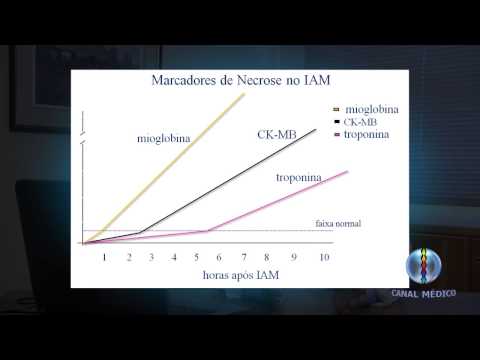 Vídeo: Identificação De Infarto Agudo Do Miocárdio Em Pacientes Com Fibrilação Atrial E Dor No Peito Com Um Ensaio Contemporâneo De Troponina I Sensível