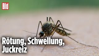 Insektenstich-Alarm: So schützen Sie sich richtig