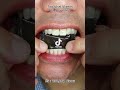 Satisfying Chewing ASMR #Compilation #ASMR #DoctorTristanPeh