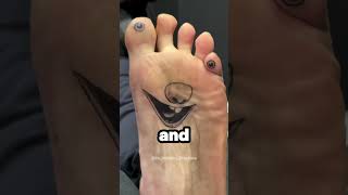 Weird feet