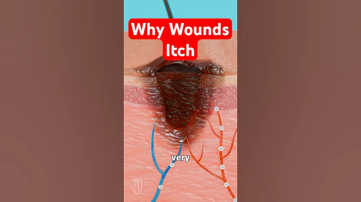 Why Wounds Itch:  Science Explained 🩹 #medical #medicalstudent #science #sciencefacts #woundcare thumbnail