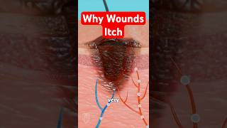 Why Wounds Itch:  Science Explained 🩹 #medical #medicalstudent #science #sciencefacts #woundcare