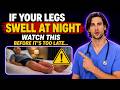 Cardiologist: 70% of People With Leg Swelling Were Dismissed Before Diagnosis