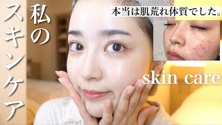 【肌荒れ写真初公開】肌荒れを治したスキンケア法