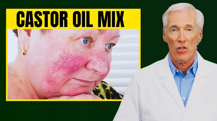 Never mix Castor Oil with these Dangerous ingredients (please)