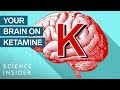 Understanding Ketamine: Uses and Effects