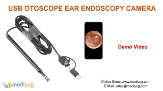 USB OTOSCOPE EAR ENDOSCOPY CAMERA screenshot 5