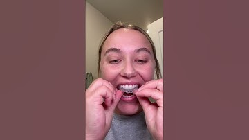 How to use whitening trays