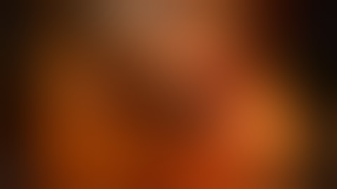 Single Site daVinci Robotic Gallbladder (Cholecystectomy) Surgery by Dr. Brodish