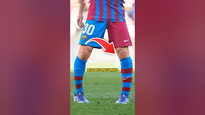 Why is football players leg curved weirdly??🤔🦵