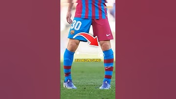 Why is football players leg curved weirdly??🤔🦵