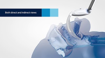 mcgrath mac video laryngoscope intubation guide video